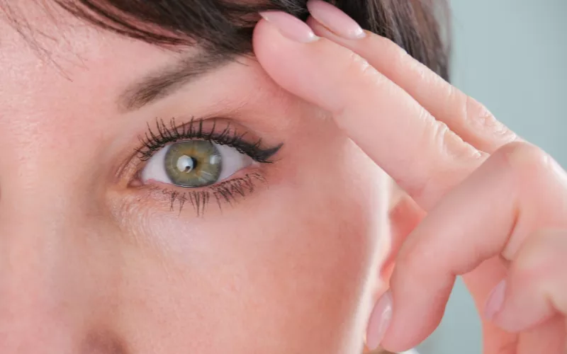 αναίμακτη βλεφαροπλαστική