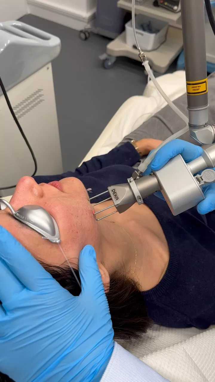 τι να προσέχεις μετά το fractional laser