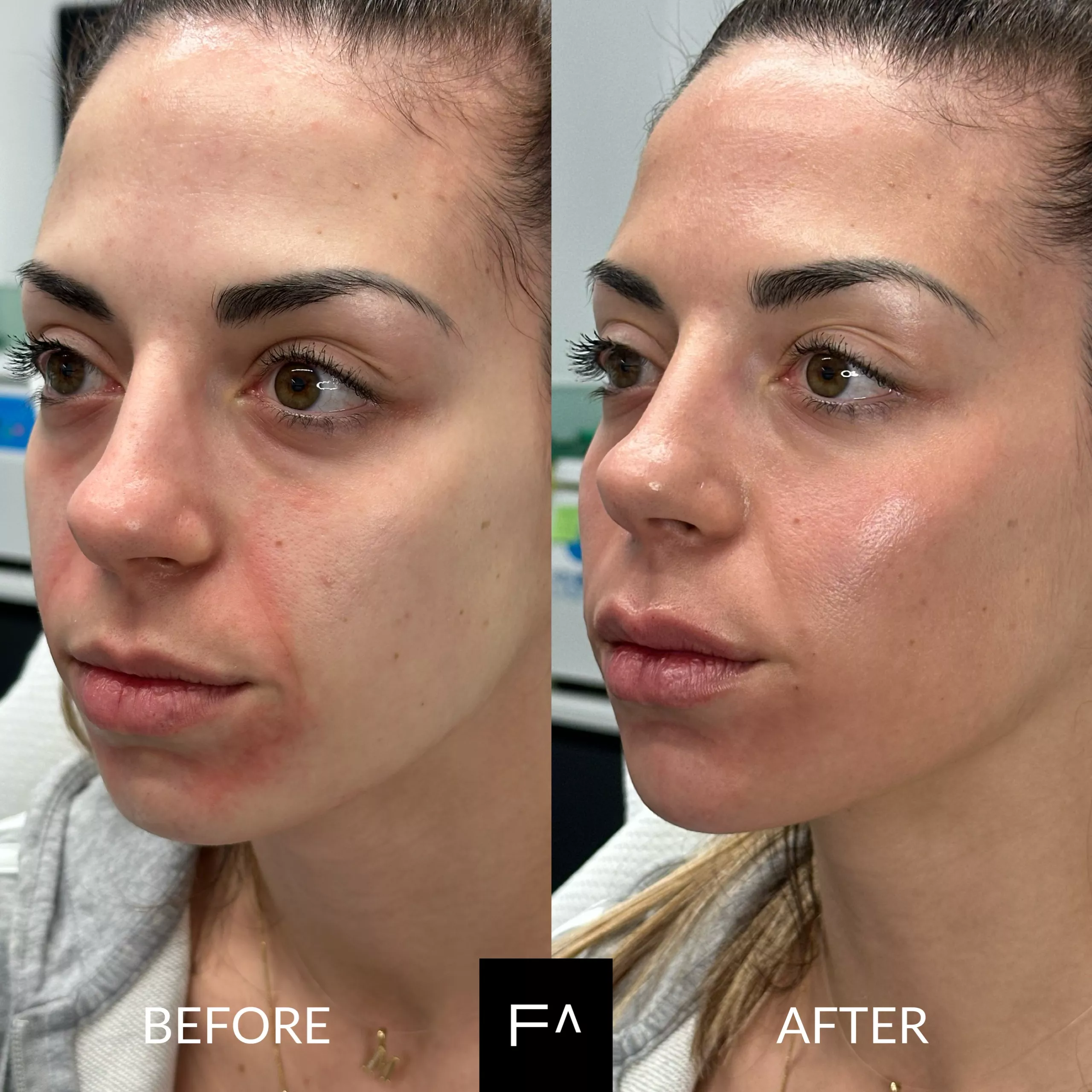 Beautification woman before & after