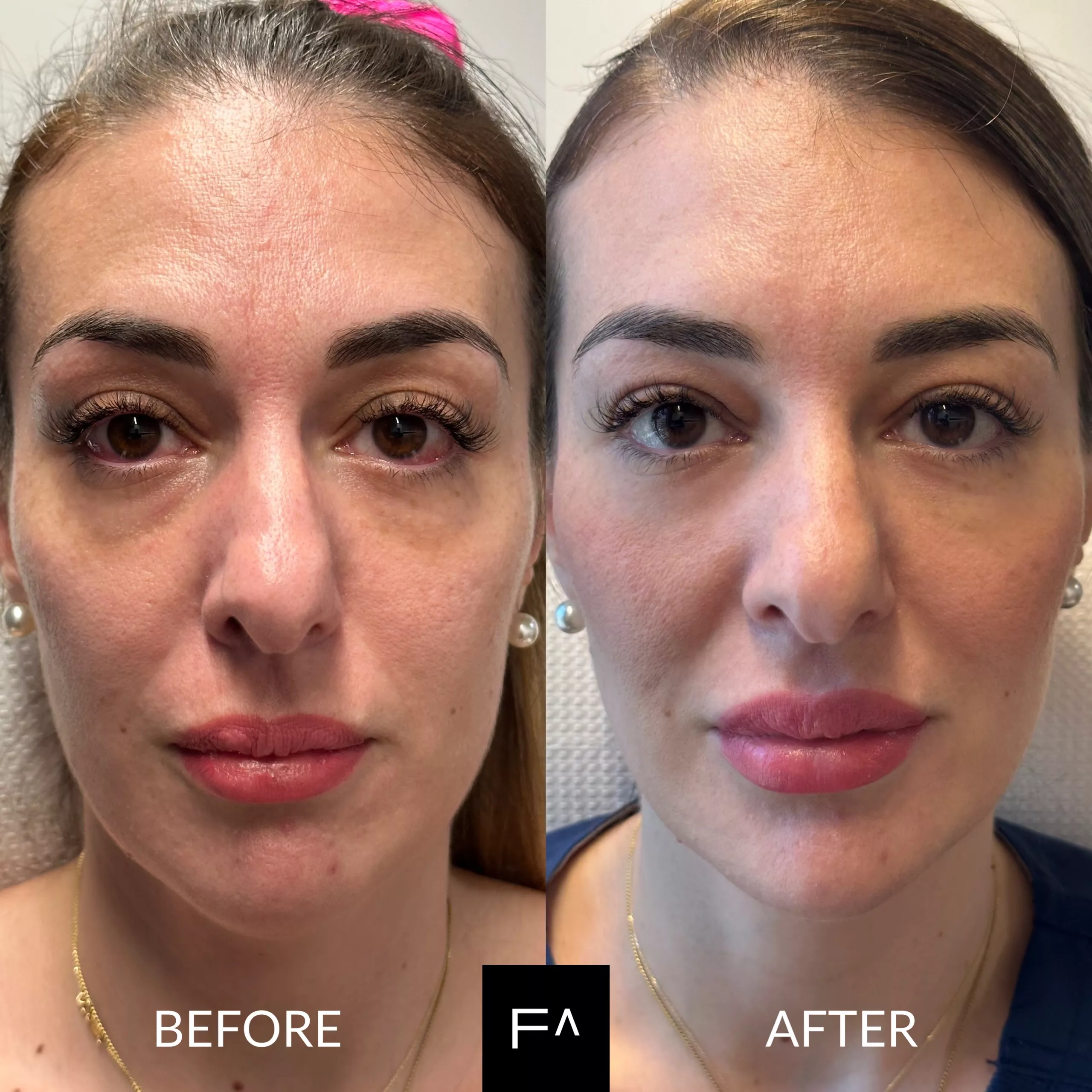 Beautification woman before & after