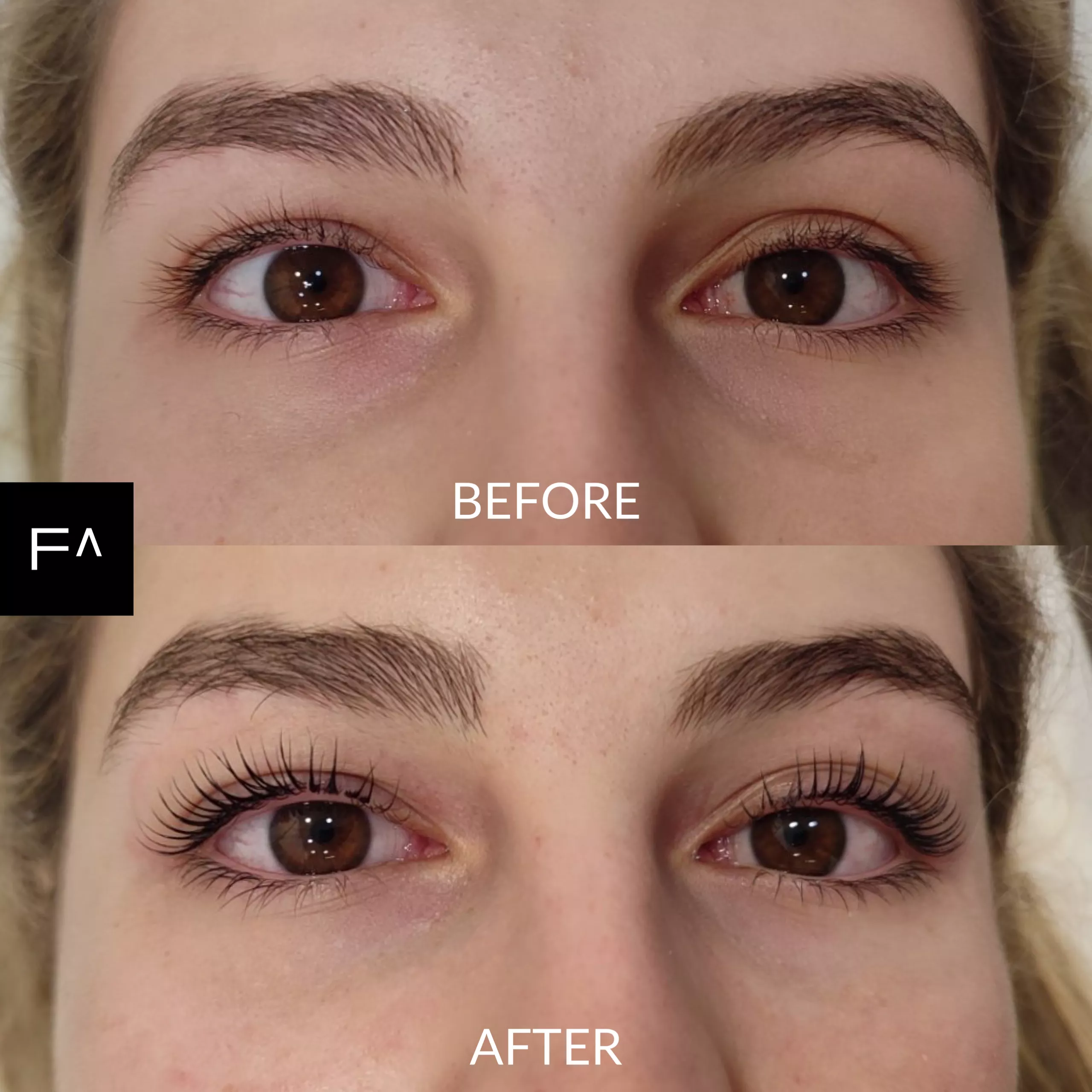 Lash lift Αθήνα στη Facemed Clinic