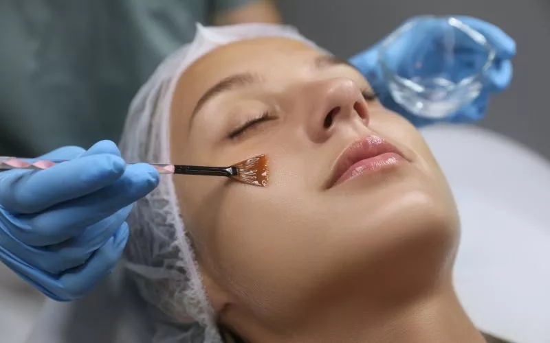υβριδικό peeling