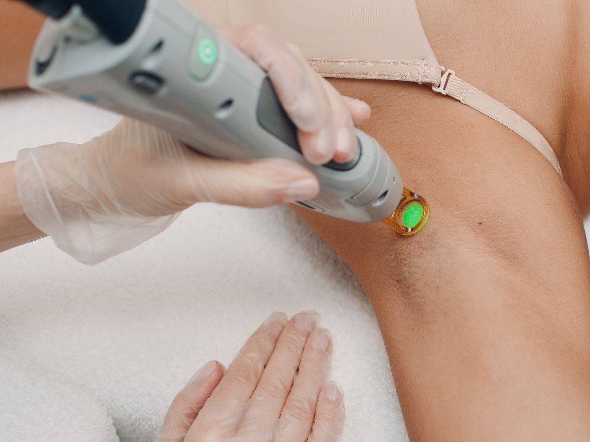 Αποτρίχωση με Λέιζερ: Παρενέργειες & Ασφάλεια