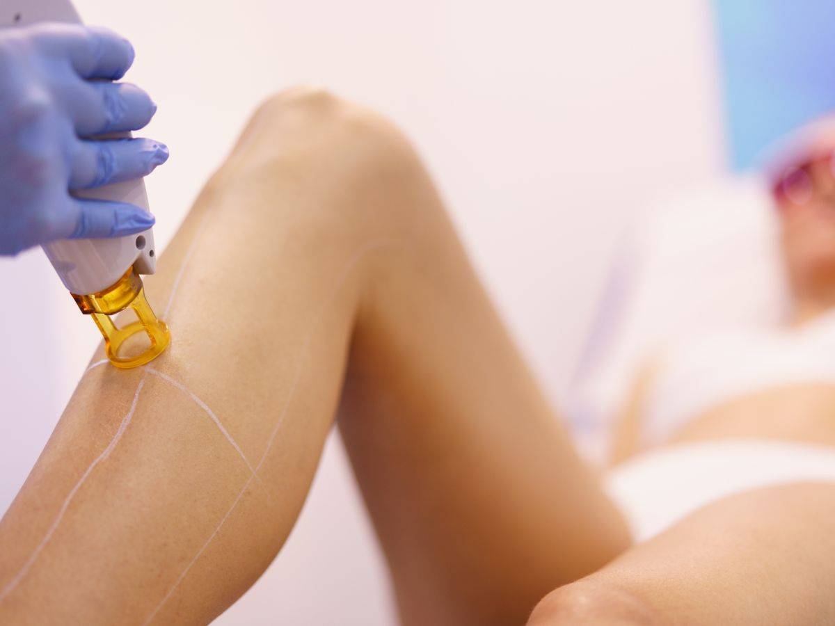 Ποιο είναι το καλύτερο λέιζερ για αποτρίχωση;