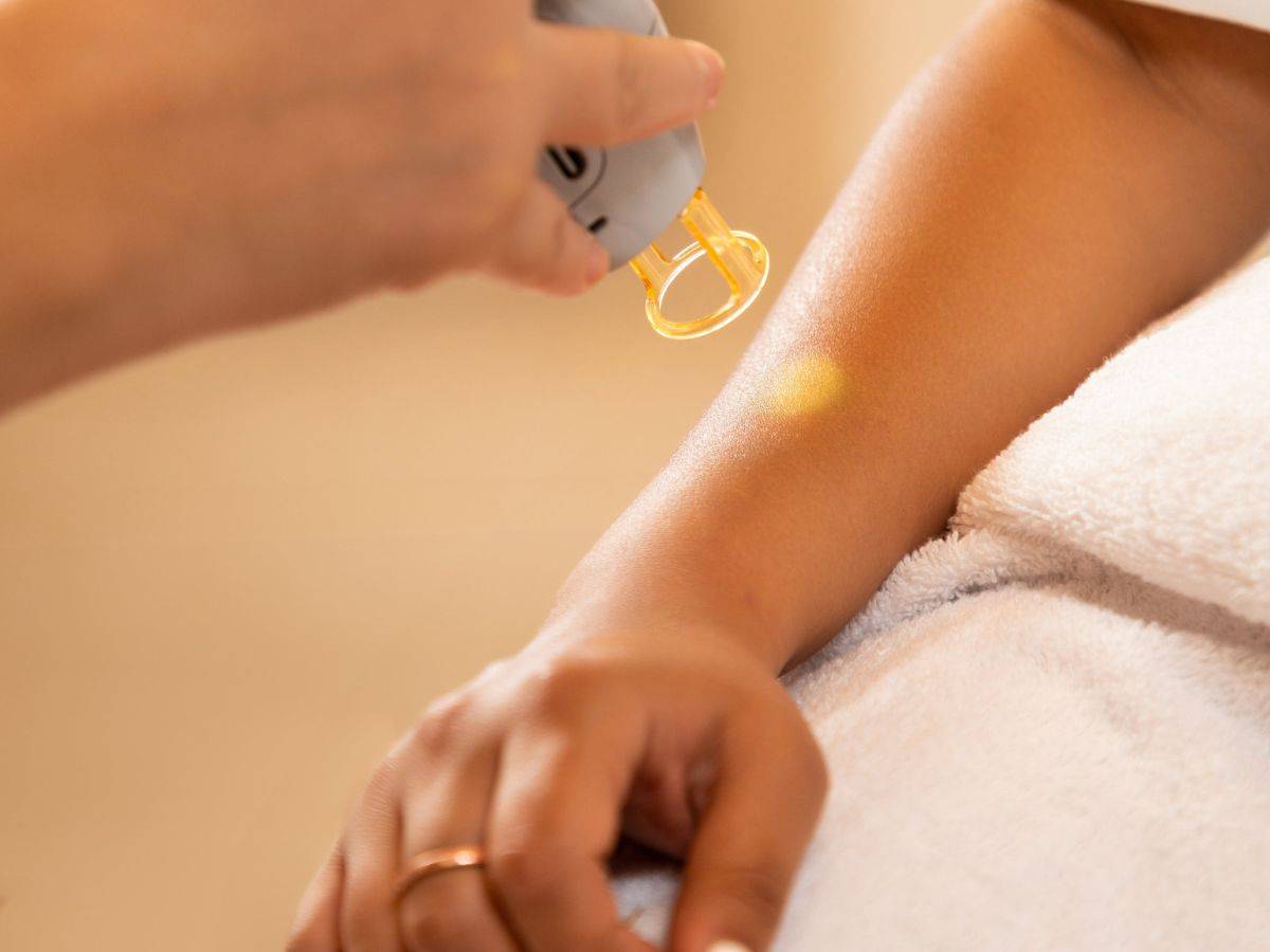 Featured image for article: Αποτρίχωση στα χέρια με λέιζερ: Όλα όσα πρέπει να ξέρεις