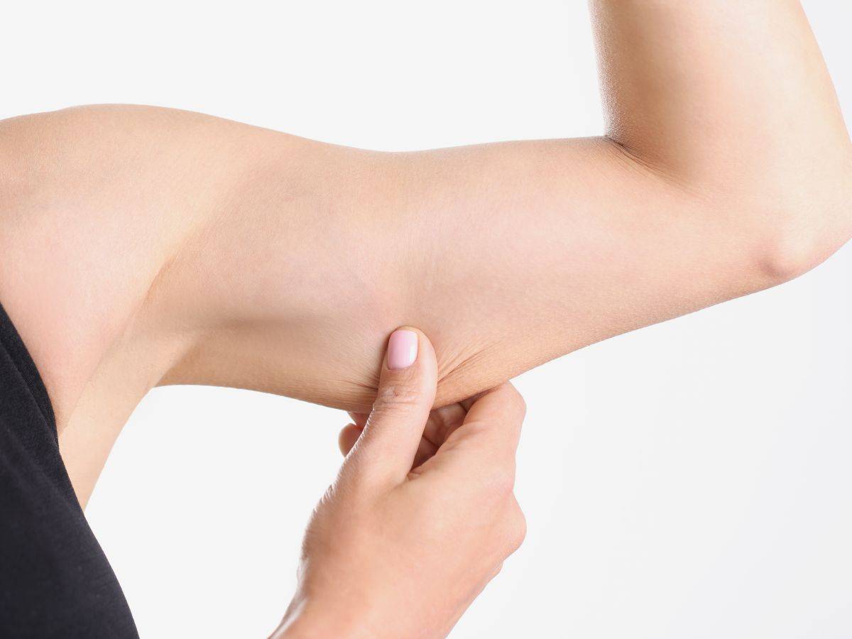 Κυτταρίτιδα στα Μπράτσα: Αντιμετώπιση