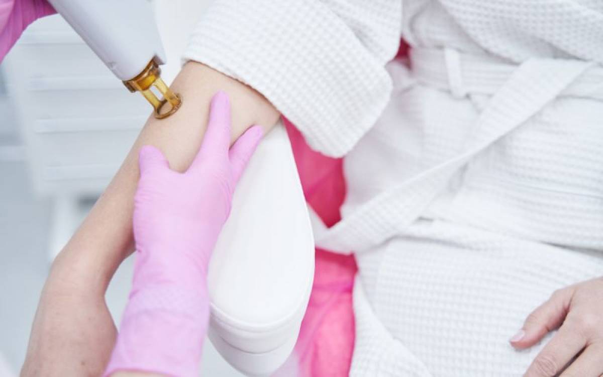 Diode laser or Alexandrite: Which is better?