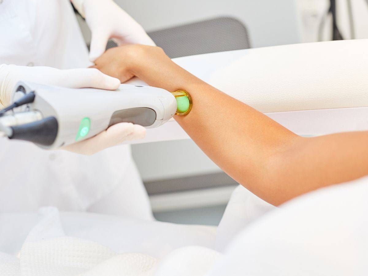 Featured image for article: Laser Αποτρίχωση: Τι Πρέπει να Ξέρω Πριν Ξεκινήσω