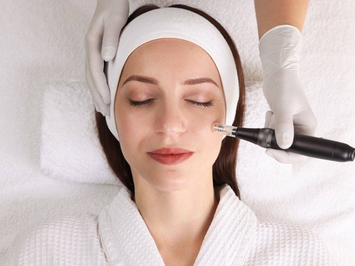 Featured image for article: Μετά το Dermapen: 6 Οδηγίες Φροντίδας